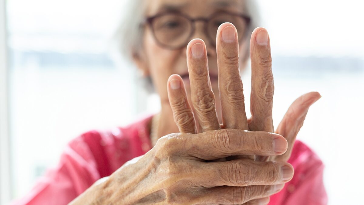 Biomarker for Autoimmune Disease